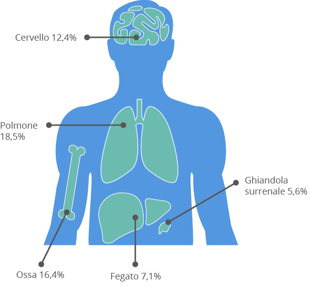 Tumore al polmone | Doctor Amgen Tumore al polmone | Doctor Amgen