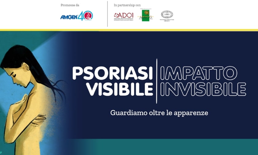 cs-psoriasi-visibile-840x505