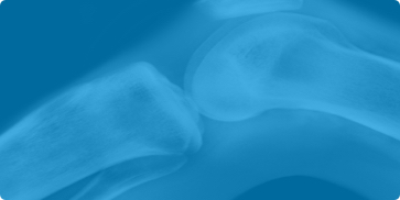 Immagine rappresentativa delle malattie infiammatorie